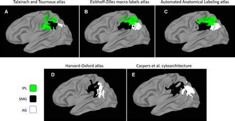 Left Inferior Parietal Lobule As Defined In Four Electronic Atlases A