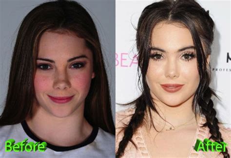 Mckayla Maroney Plastic Surgery Results Silence And Denial