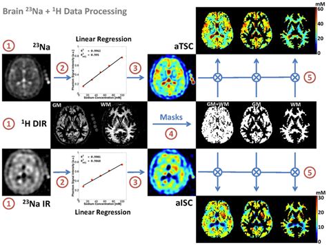 Diagram Of The Brain Mri Data Processing The Process Is Divided In