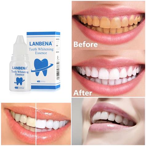 10ml Liquid Teeth Whitening Essence Serum Removes Oral Hygiene Cleaning