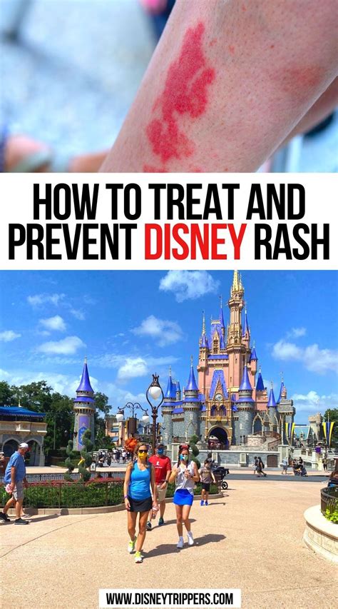 How To Treat And Prevent Disney Rash In 2021 Travel Fun Usa Travel