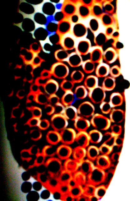 Trypophobia Fear Of Holes Flickr Photo Sharing