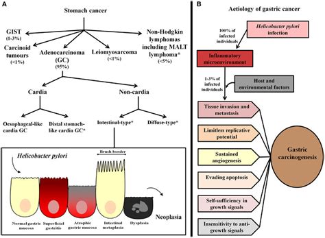 Gastric Cancer Classification And Etiology A Stomach Cancer