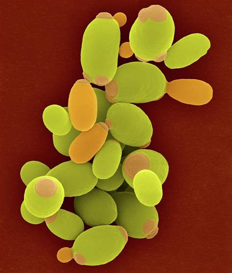 Candida Yeast Candida Parapsilosis Photograph By Dennis Kunkel