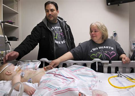 Surgeons Separate Twins Conjoined At Chest Abdomen