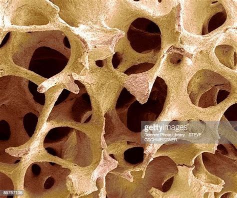 Spongy Bone Tissue Photos And Premium High Res Pictures Getty Images