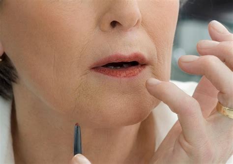 Exciting New Approach To The Treatment Of Upper Lip Lines Skincare