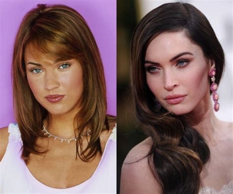 Megan Fox Plastic Surgery Before And After Pictures 2014 2015