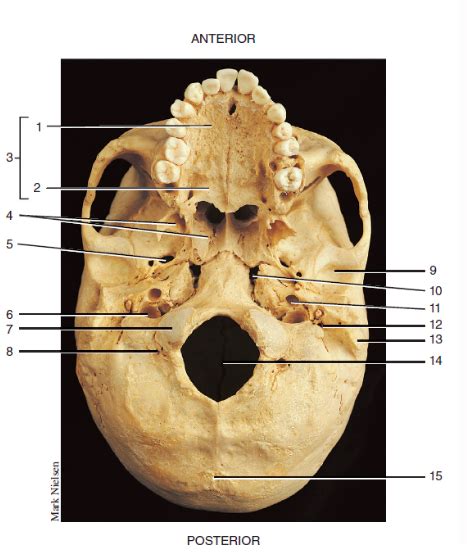 Figure 99 Inferior View Of Skull Diagram Quizlet