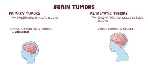 Brain Tumors Clinical Video Anatomy Definition Osmosis