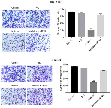 mir‑590‑5p may regulate colorectal cancer cell viability and migration by targeting pdcd4