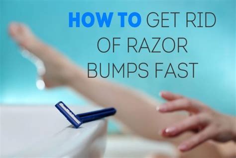 How To Get Rid Of Razor Bumps Burns Go Itch Free Scoopify