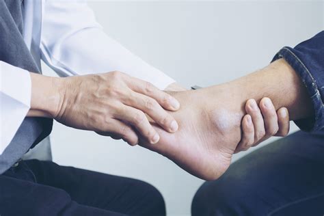 Four Sprained Ankle Symptoms — Dr John Paul Elton