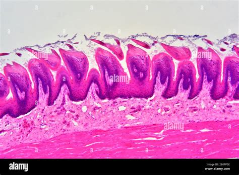 Filiform Papillae In A Tongue Longitudinal Section X75 At 10 Cm Wide
