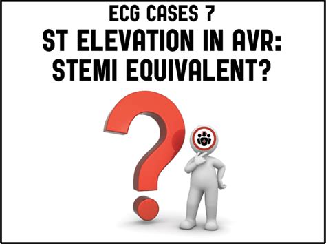 St Elevation In Avr Stemi Equivalent Ecg Cases Emergency Medicine
