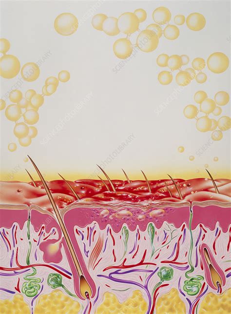 Impetigo Stock Image M1800092 Science Photo Library