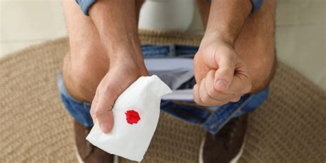 Heute Wirtschaft Fünfte Blut Am Toilettenpapier Aber Nicht Im Stuhl