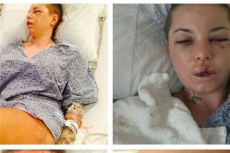 Broken Christy Mack Issues Full Statement Graphic Photos In Wake Of Alleged Savage Assault From