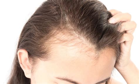 5 Common Hair And Scalp Problems You Should Be Aware Of