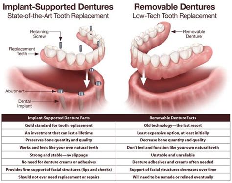 Dentaltown Where The Dental Community Lives® Dental Implants Cost