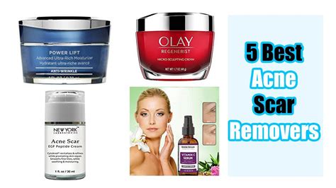 Top 5 Best Acne Scar Removers Reviews Advanced Ultra Rich Moisturizer