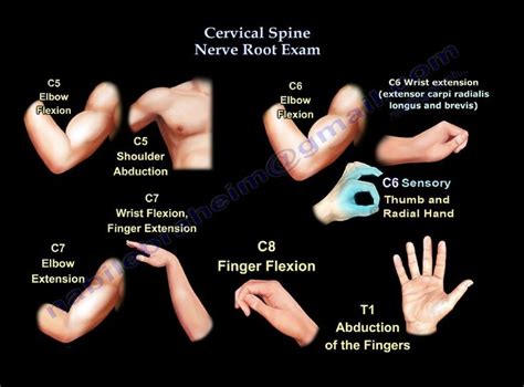Cervical Spine Nerve Root Exam Everything You Need To Know Dr
