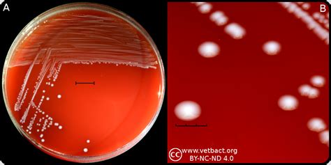 Enterococcus Faecalis Macconkey Agar