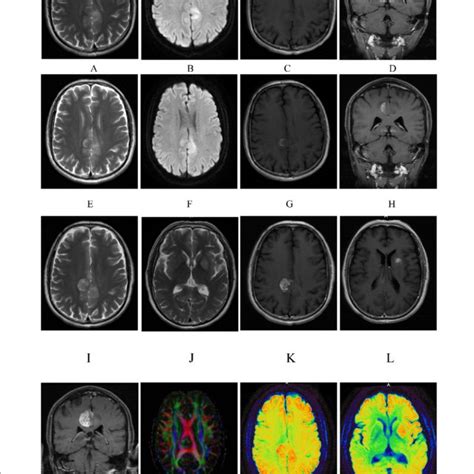 Brain Mri Imaging Of The Patient Brain Mri Plain Scan And Enhanced