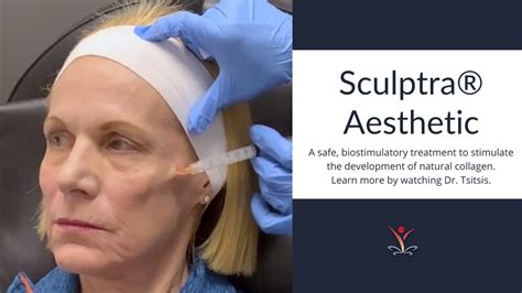 Why You Should Consider Sculptra® Aesthetic Youtube