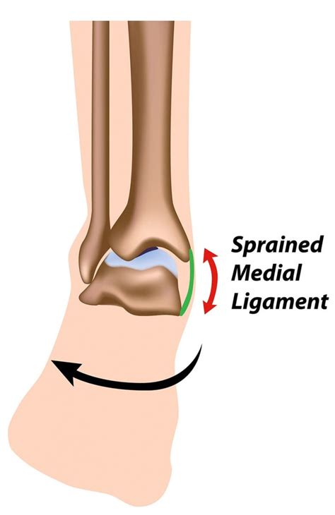 3 Ligaments In Ankle Ligaments Of The Foot And Ankle Overview
