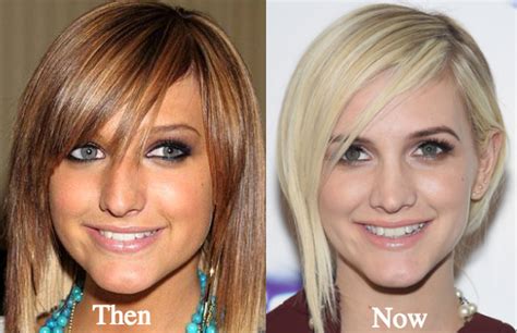 Ashlee Simpson Plastic Surgery Before And After Photos Latest Plastic