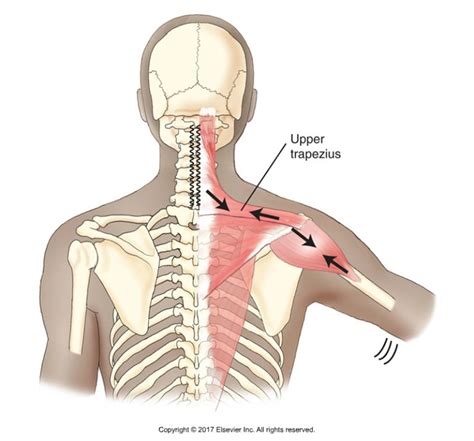 Six Causes Of Shoulder Impingement Syndrome Part