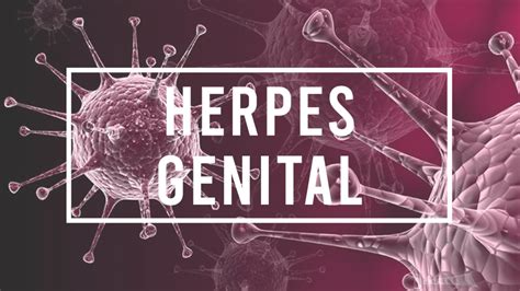 infección por herpes genital urovanguardia