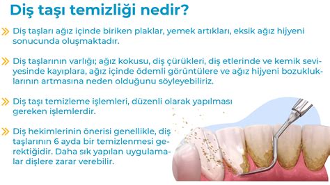 Diş Taşı Tedavisi