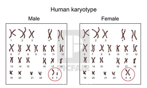 Human Chromosomes Male Vs Female Karyotype Illustration License