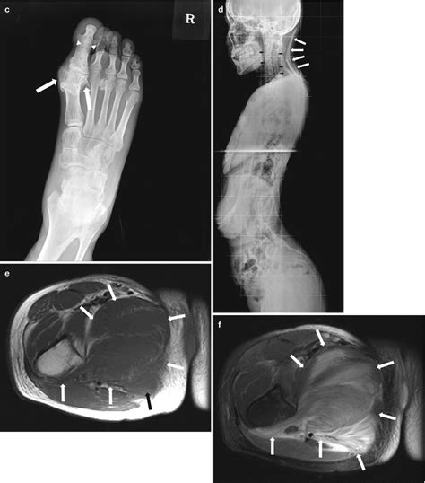 Soft Tissue Diseases Radiology Key