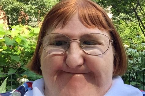 Disabled Blogger Told She Was Too Ugly For Selfies Keeps On Posting
