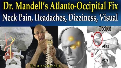 Dr Mandells Atlanto Occipital Fix For Headaches Neck Pain Trap