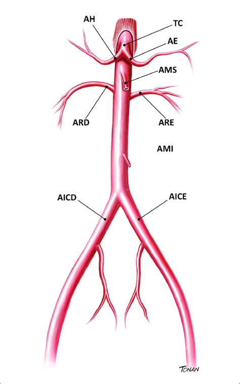 Arteria Aorta Abdominal