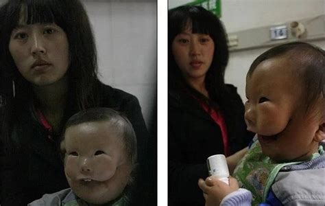 These Terrifying Photosvideo Of Baby Born With Two Faces Will Leave