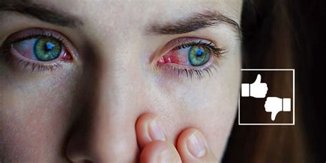 Why Cannabis Causes Red Eyes And What To Do About It Zamnesia Blog
