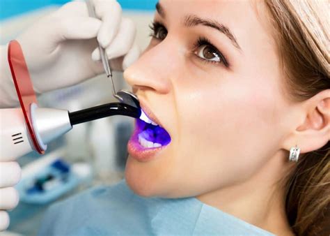How Dental Bonding Can Eliminate Gaps In Teeth Houston Dentists At