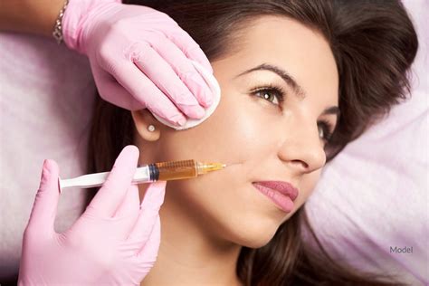 Your Ultimate Guide To Injectable Dermal Filler Placement