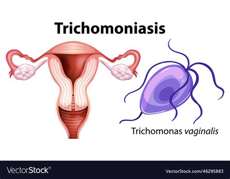 Trichomonas Vaginalis On White Background Vector Image