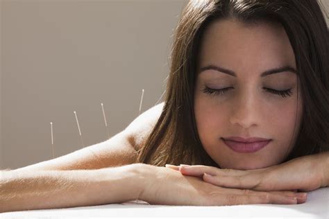 What Acupuncture Is Like For Fibromyalgia And Mecfs