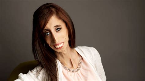 From World’s Ugliest Woman To Motivational Speaker And Author Fox News