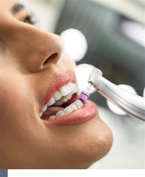 Laser Teeth Polishing Service In Alberta