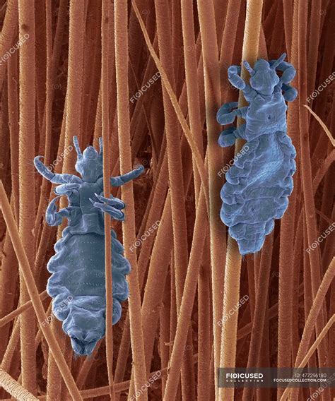 Coloured Scanning Electron Micrograph SEM Of Pediculus Humanus