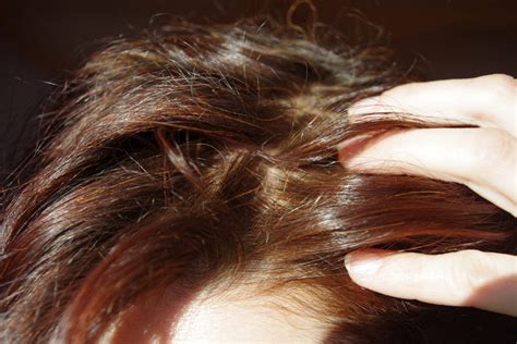 Reader Request How To Deal With A Smelly Scalp Venusianglow