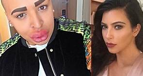 Fanático de Kim Kardashian se opera ¡para parecerse a ella!